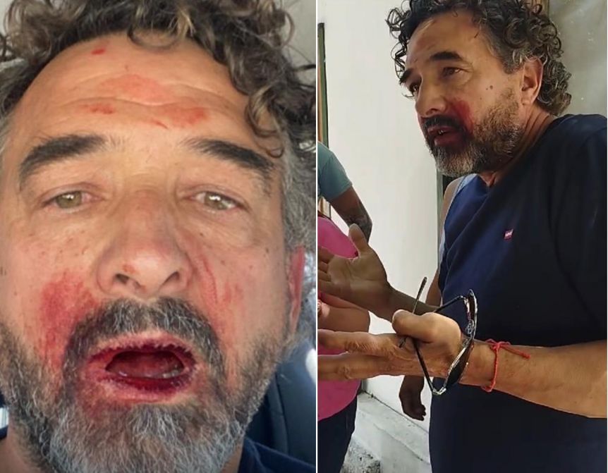 Solicitaron la apertura de investigación por la agresión sufrida por Alejandro Albaini