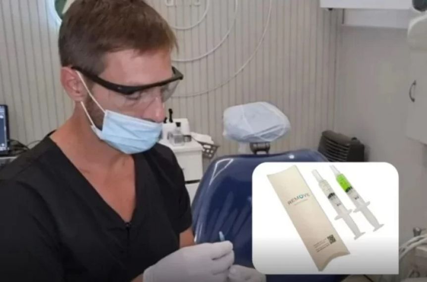 Adiós al torno: un odontólogo creó un gel que elimina las caries