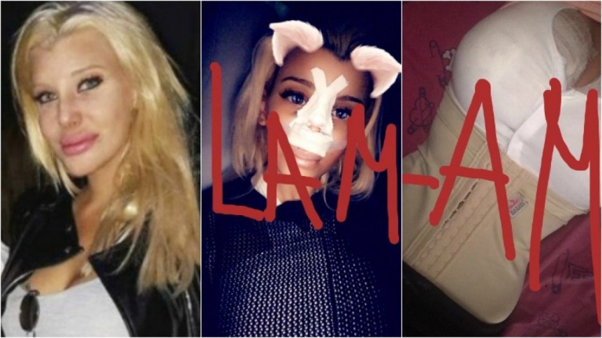 Las fotos de Charlotte Caniggia luego de operarse nariz y lolas
