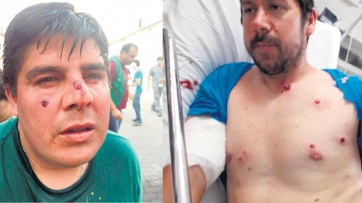 Cierre de año caliente: Gobierno reprimió protesta de ATE y se intesifican las medidas de fuerza