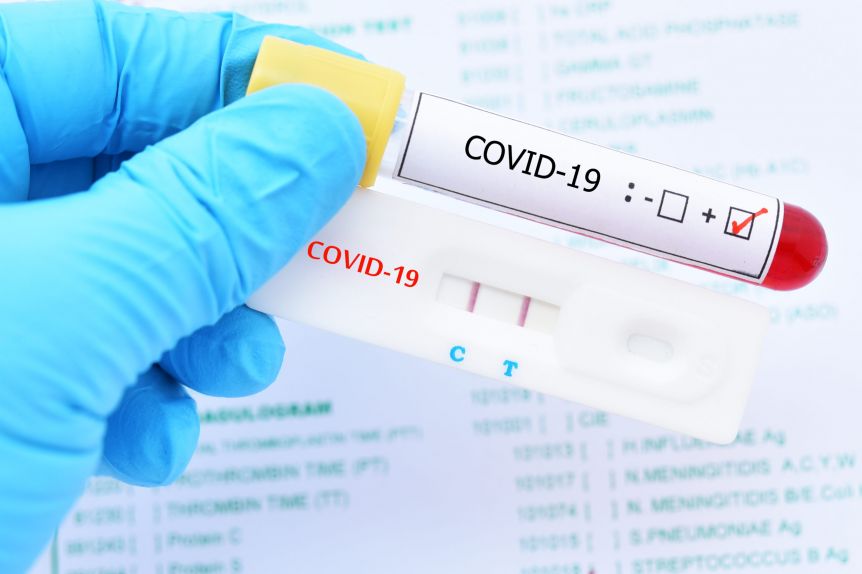 Salud amplió la definición de caso positivo de Covid-19