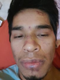Brutal tortura de la policía a un enfermero: “Se reían y me decían ´feliz día del padre´”