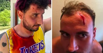Carreras repudió el ataque que sufrieron dos turistas en Bariloche