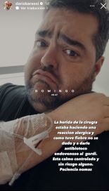 Darío Barassi sufrió una complicación en su postoperatorio y tuvo que ser internado de urgencia